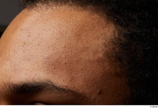 HD Face skin Javion Norris face skin pores skin texture…